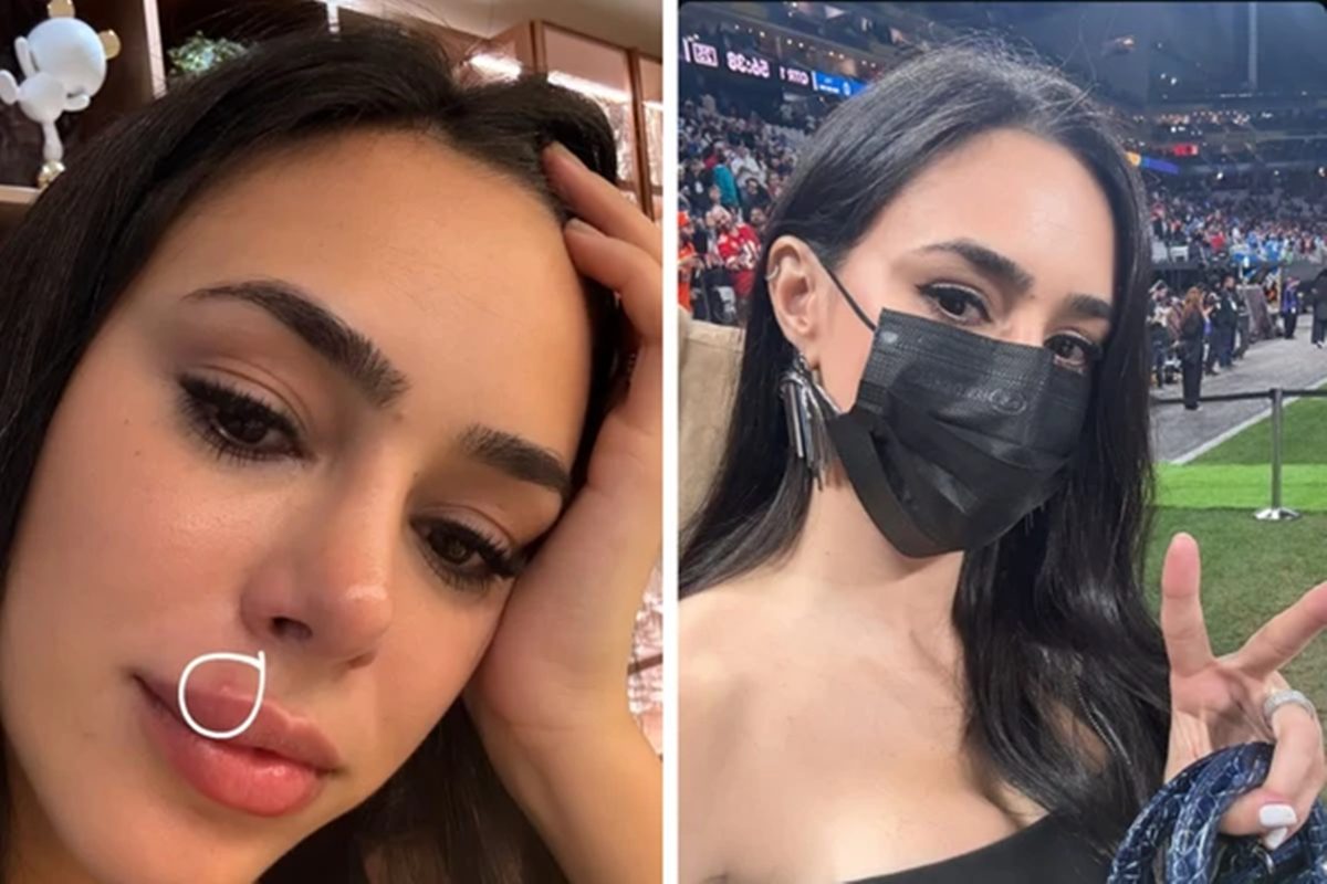 Inchaço facial preocupa fãs: Bruna Biancardi explica o que aconteceu.